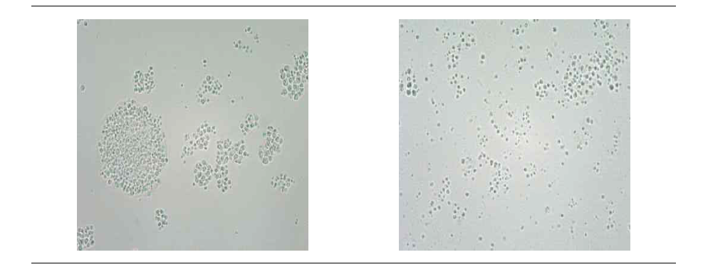 PB-75 5KL 3차 배양 결과 (배양액 현미경 사진) (좌 상 - 20x 79h, 우 상 - 20x 133.55h)