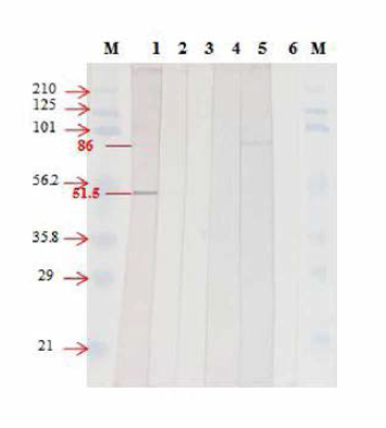 5개 (8-1C8, 39H3, 66F2, 76A10, 76H2) 단클론 항체의 RSIV 인식 부위. M: marker (kDa), 1： 8-1C8, 2： 39H3, 3： 66F2, 4： 76A10, 5： 76H2
