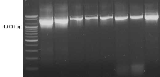 PCR profile using 16S rDNA primer set