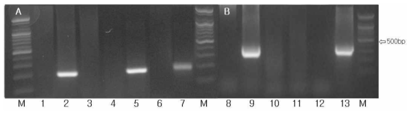 Detection of the VHSV(A) and NNV(B) by RT-PCR. (M: Marker; lane 2, 5 : positive sample; lane 1, 3, 4, negative sample; lane 6, negative control; lane 7, positive control; lane 8, 9, 10, 11 negative sample; lane 9, positive sample; lane 12, negative control; lane 13, positive control)