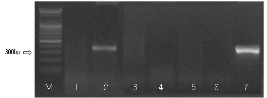 Detection of the NNV by RT-PCR. (M: Marker; lane 2 : positive sample; lane 1, 3, 4, 5 negative sample; lane 6, negative control; lane 7, positive control)