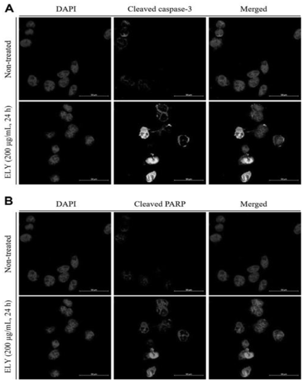 Effects of ELY on the expression of cleaved caspase-3 and cleaved PARP. After HeLa cells treated with ELY, the expression levels of proteins were detected by immunofluorescence staining and observed by confocal microscopy (blue: DAPI, green: cleaved caspase-3 and red: cleaved PARP). Scale bars = 50 μm