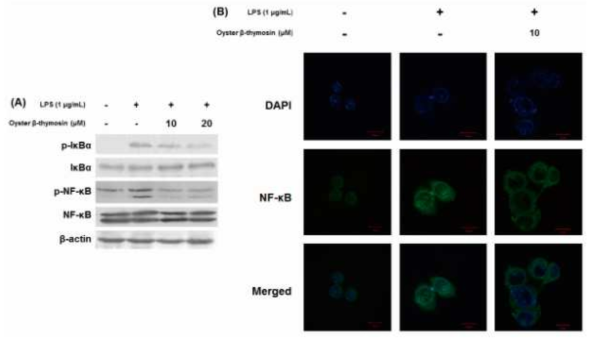 Effects of oyster β-thymosin on phosphorylation of either NF-κB or IκBα, and NF-κB translocation in LPS-stimulated RAW264.7 cells. Cells were pretreated with the designated concentration of oyster β-thymosin for 2 h and induced with LPS (1 μg/mL) for 2 h (A) and for 24 h (B). (A) Cell lysates were subjected to Western blot analysis using antibodies against p-IκBα, IκBα, p-NF-κB and NF-κB. β-actin was used as an internal control. (B) Translocation of NF-κB was detected by immunofluorescence staining. Cells were stained with DAPI (4',6-diamidino-2-phenylindole) for visualization of nuclei (blue) and NF-κB immunofluorescence antibody (green), magnification × 1000, scale bar 10 μm