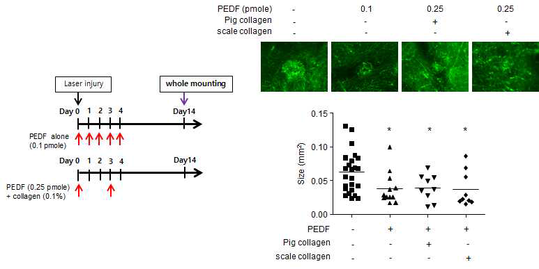 PEDF-collagen 혼합물의 나이관련 황반변성에 대한 치료제로서의 가능성