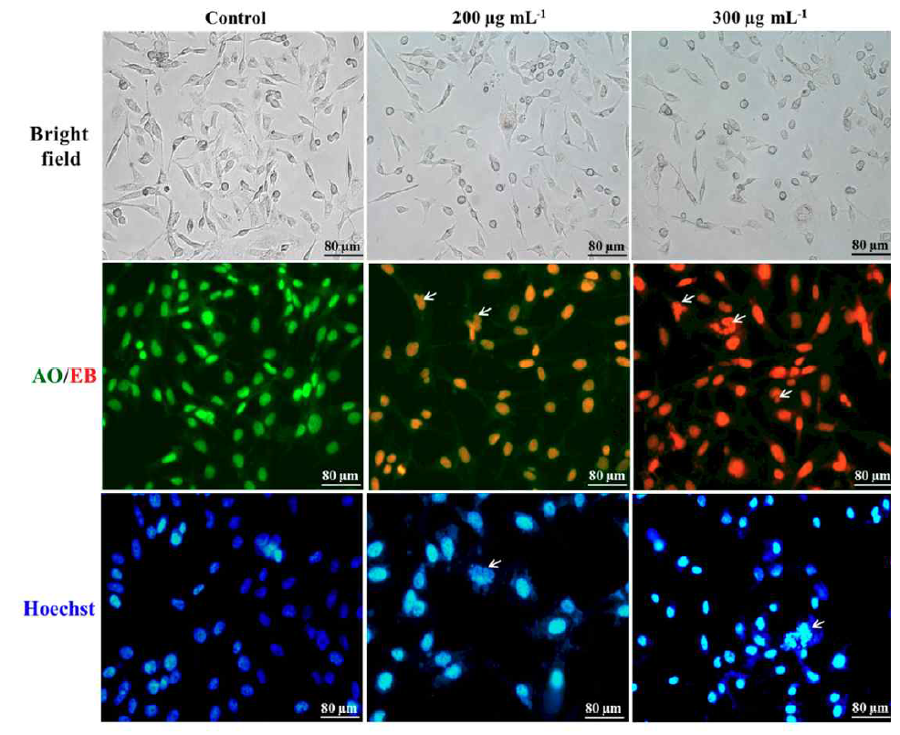 PDT로 처리 한 MBA-MD-231 세포의 밝은 영역 및 형광 현미경 이미지