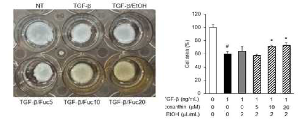 TGF-β 유도 세포에서 후코산틴의 collagen contraction assay