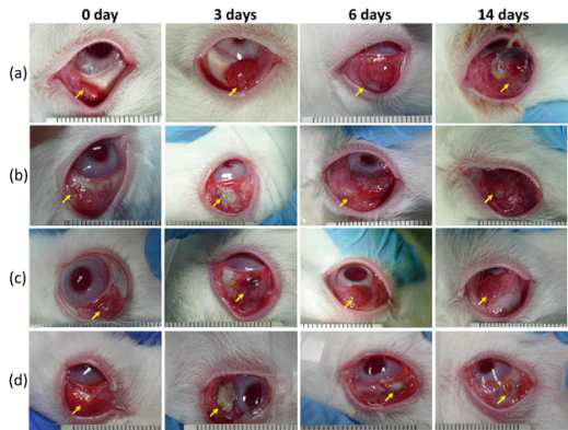 토끼 종양모델 (안구)에서 fucoidan 이용 광감작제를 이용한 광열치료 실험