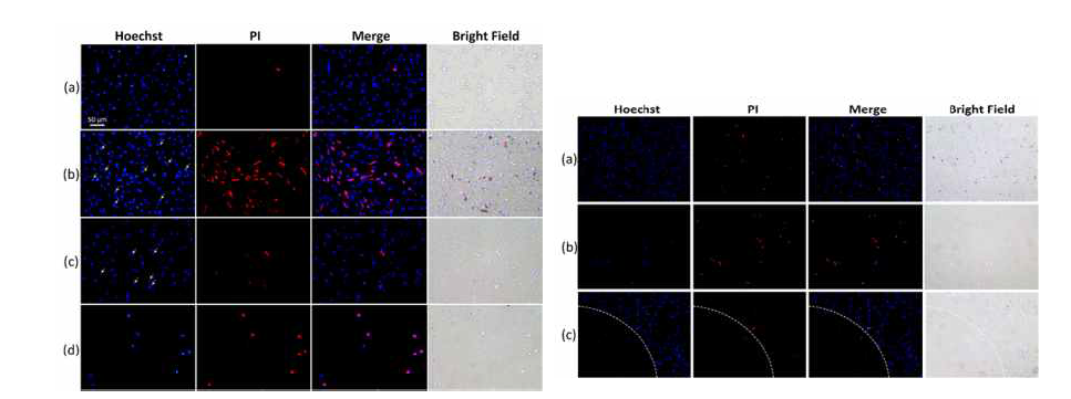 astaxanthin을 이용한 광열치료를 통해 종양세포가 사멸되는 것을 형광현미경 이미지를 통해 증명함
