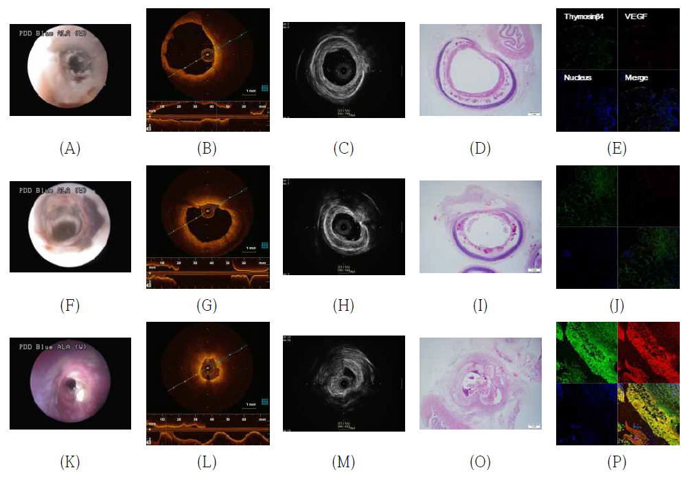 기도 협착 모델 생성 후 acute (A~E), subacute (F~J), chronic (K~P) stage 별 multimodal imaging
