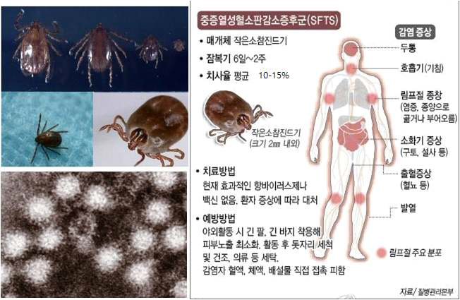 SFTSV의 전파매개체인 참진드기와 인체 감염에 대한 임상 증상