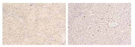 조직 내에서 monoclonal antibody를 활용한 SFTSV 탐지