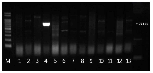 blaSHV 유전자 확인결과 M: size marker, 1: strain 2(국내산), 2: strain 136(국내산), 3: strain 202(국내산), 4: strain 203(국내산), 5: strain 240(국내산), 6: strain 303(국내산), 7: strain 575(국내산), 8: strain 617(국내산), 9: strain 80(수입산), 10: strain 216(수입산), 11: strain 306(수입산), 12: strain 318(수입산), 13: strain 327(수입산)