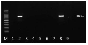 blaCTX-M-9 유전자 확인결과 M: size marker, 1: strain 100(국내산), 2: strain 102(국내산), 3: strain 273(국내산), 4: strain 311(국내산), 5: strain 521(국내산), 6: strain 526(국내산), 7: strain 73(수입), 8: strain 235(수입), 9: strain 302(수입)