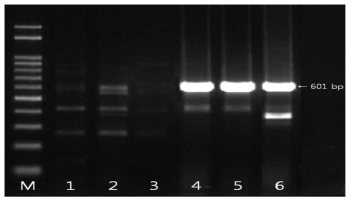 blaCTX-M-8 유전자 확인결과 M: size marker, 1: strain 8(국내산), 2: strain 31(국내산), 3: strain 174(국내산), 4: strain 10(수입산), 5: strain 174(수입산), 6: strain 177(수입산)