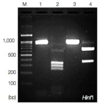 붕장어에서 얻은 고래회충 유충의 DNA를 추출하여 PCR-RFLP법을 이용하여 종을 동정한 결과 (Cho et al., 2015)