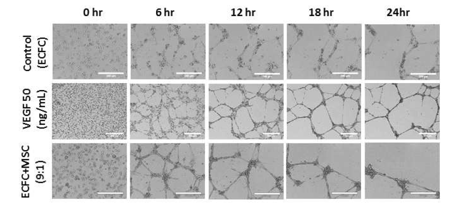 Time-dependent reperesentative image of tube formation by human endothelial colony forming cells (ECFC)+mesenchymal stem cells (MSC) in the presence and absence of vascular endothelial growth factor (VEGF) for 48 hours