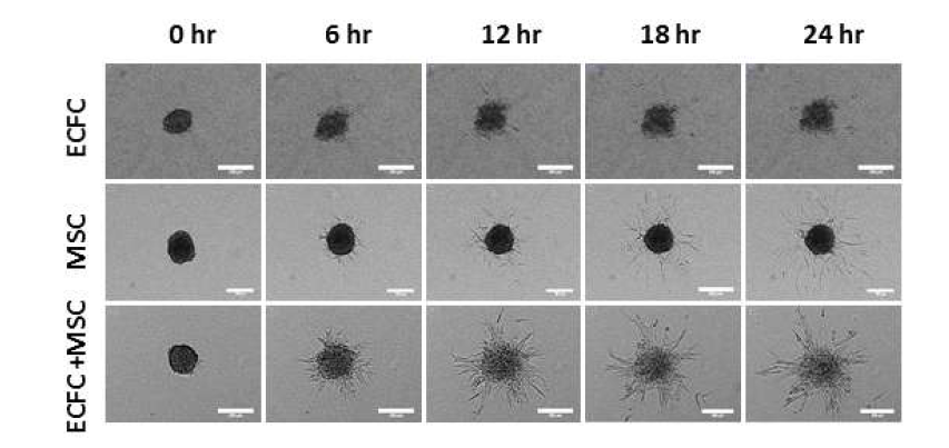 Time-dependent reperesentative image of sprouting formation from spheroids of human endothelial colony forming cells (ECFC), mesenchymal stem cells (MSC), or ECFC + MSC for 24 hours