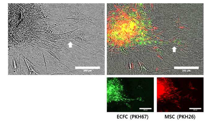 Representative images of sprouting formation from spheroids of human endothelial colony forming cells (ECFC;green) + mesenchymal stem cells (MSC; red) with each fluorescent staining at 24 hours