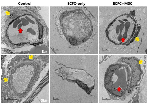 Representative electron-microscope images of Matrigel mixed with ECFC-only and ECFC+MSC. Control is micro vessels in the ear and skin