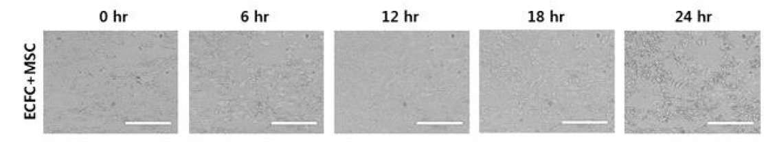 Trial of nanopatterned plate for angiogenesis by human endothelial colony forming cells (ECFC) and mesenchymal stem cells(MSC)