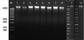 Genomic analysis of Vibrio strains on gel electrophoresis