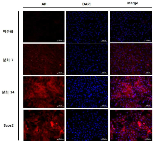 분화된 조골세포의 Alkaline Phosphatase (AP) 면역형광염색 결과