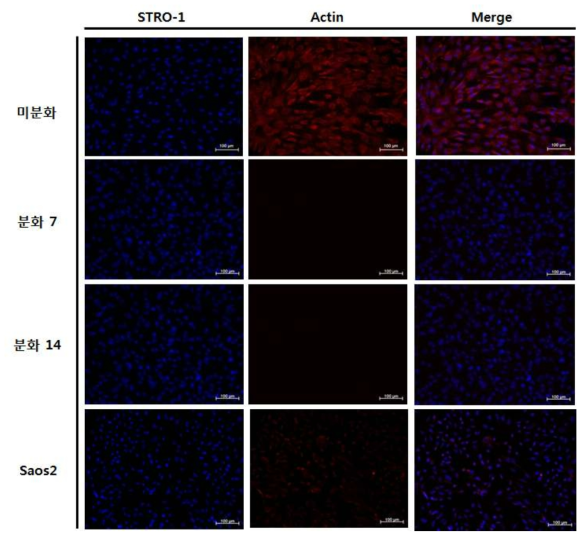 분화된 조골세포의 STRO-1 면역형광염색법
