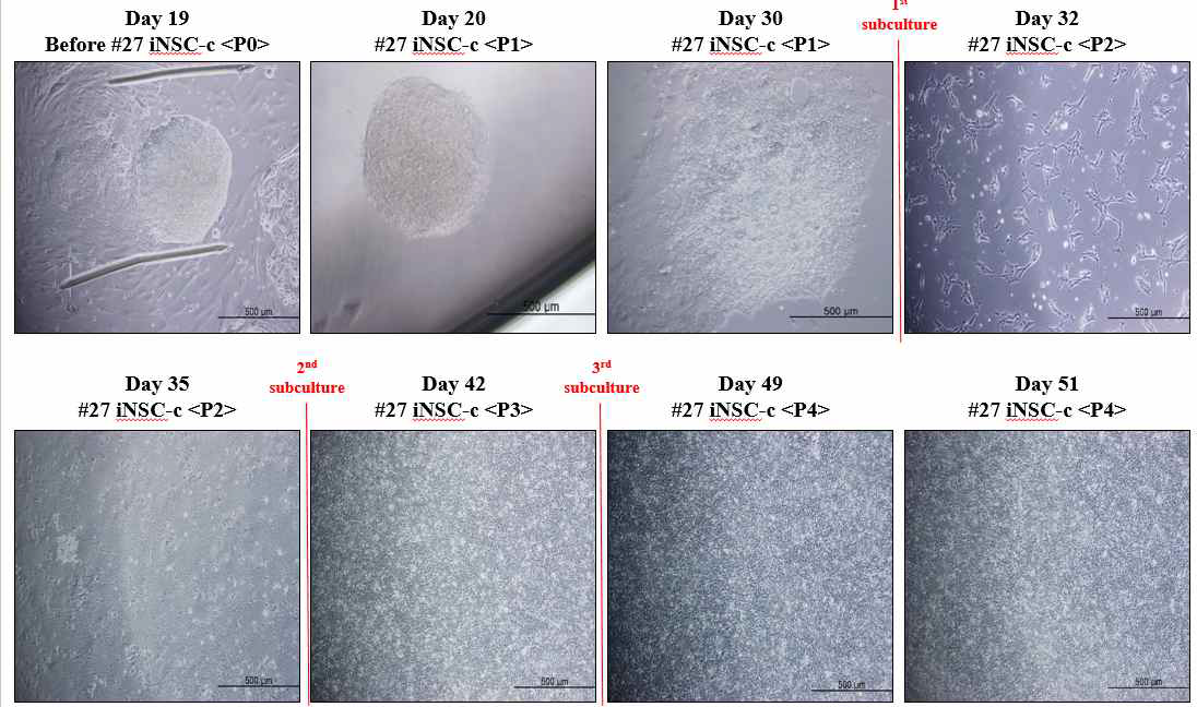 직접교차분화 과저에서의 세포 형태 변화(Day 19 ∼ Day 51)