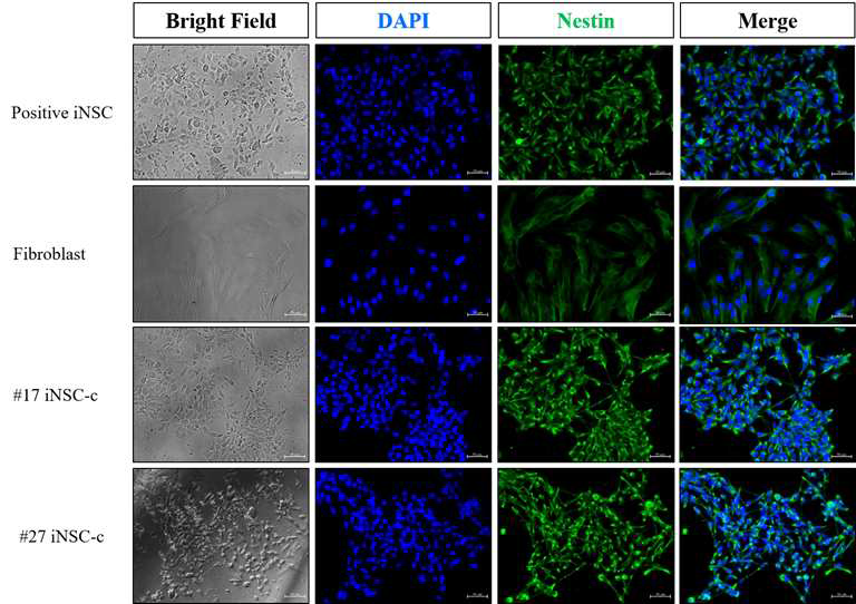 분화유도된 신경줄기세포의 단밸질 발현 양상(Nestin)