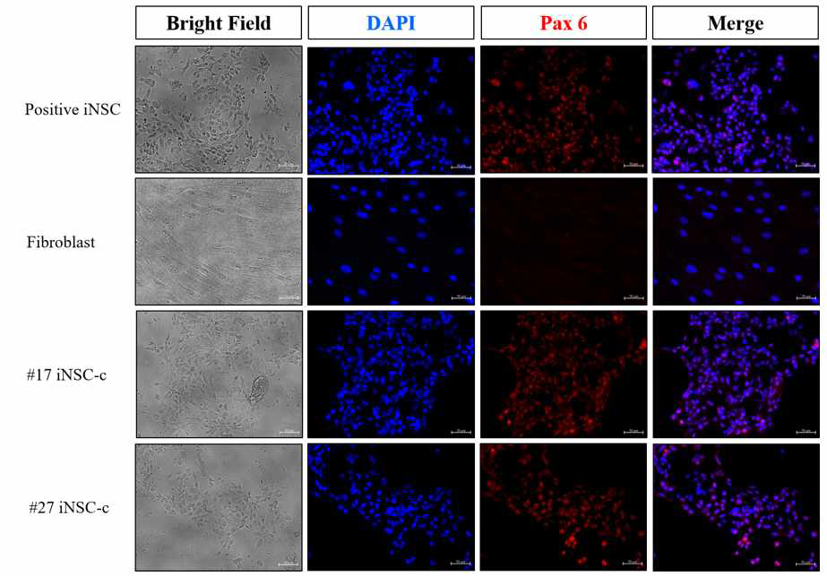 분화유도된 신경줄기세포의 단밸질 발현 양상(Pax 6)