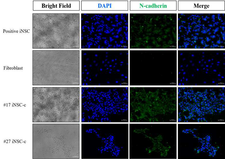분화유도된 신경줄기세포의 단밸질 발현 양상(N-cadherin)