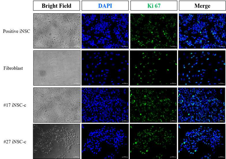 분화유도된 신경줄기세포의 단밸질 발현 양상(Ki67)