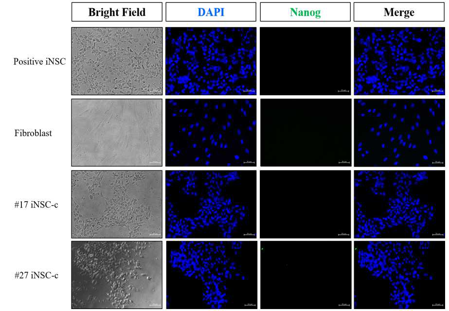 분화유도된 신경줄기세포의 단밸질 발현 양상(Nanog)