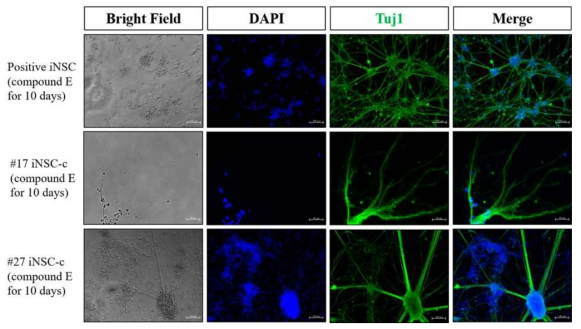 분화유도된 신경세포의 단밸질 발현 양상(Tuj1)