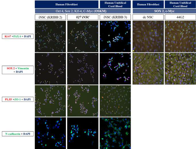 서로 다른 방법으로 만들어진 신경줄기세포의 단백질 발현 확인