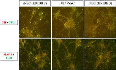신경세포 특이적인 단백질 발현 확인