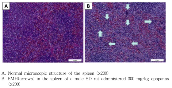 오포파낙스 28일 반복독성시험 비장 H&E 염색 (수컷)