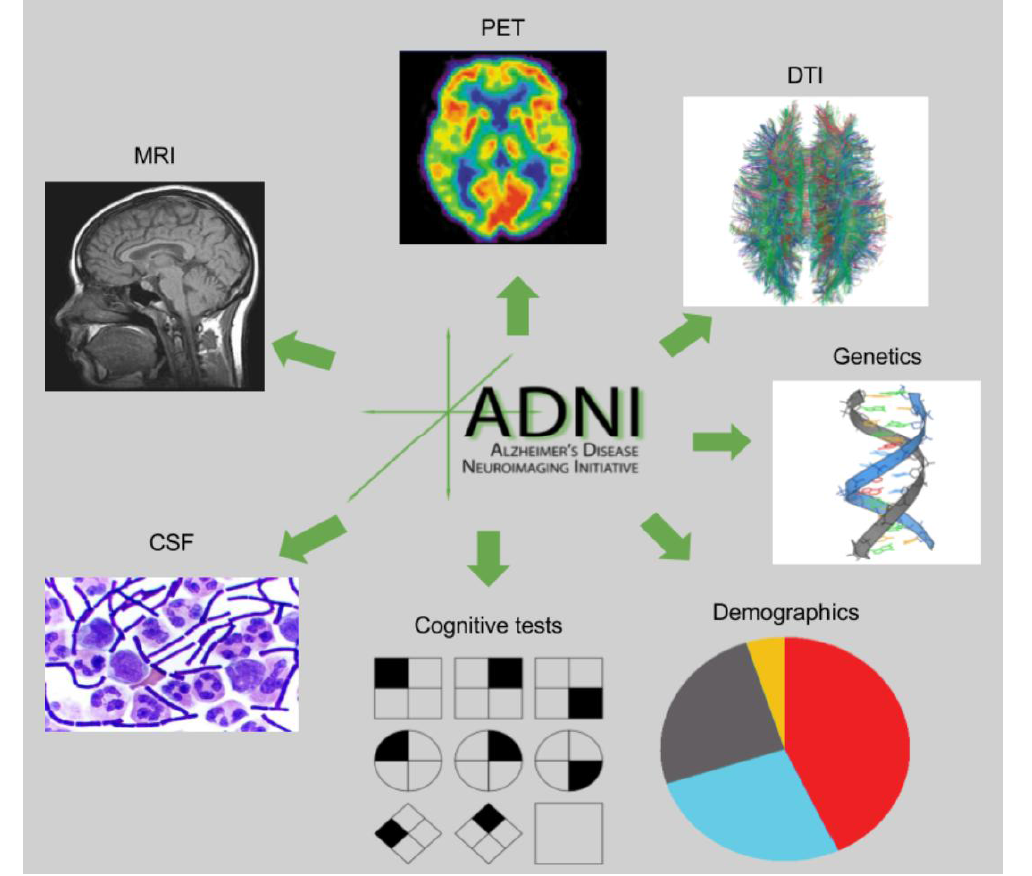 ADNI의 주요한 역할은 임상시험을 위한 biomarker를 개발하는 것임