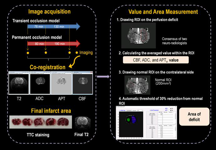 Rat MCA infarction model에서 재관류와 영구 경색을 만들어 APT-weighted MRI를 이용한 이용하여 조직검사와 영상검사의 비교 분석을 시행하고자 함