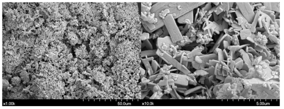 표준 치약에 사용된 마모제 입자 (calcium pyrophosphate)의 SEM 사진