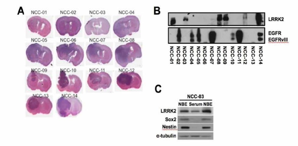 기존 확립된 환자유래 세포주에서 LRRK2의 발현과 돌연변이체의 존재여부