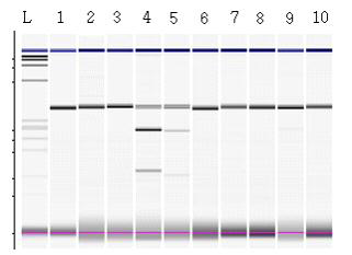 S-genotypes analysis of Shinhwa(S5S?) cultivars by PCR-RFLP analysis. L,1Kb ladder; 1,Uncut PCR product; 2,SfcⅠ(S1 specific); 3,AflⅡ(S2 specific); 4,PpuMI (S3,S5 specific); 5,AlwNI (S5 specific); 6,NdeⅠ(S4 specific); 7,HinCⅡ(S6, S7 specific); 8,MluⅠ(S7 specific); 9,NruⅠ(S8 specific); 10,BstBⅠ(S9 specific). Each digested fragment was loaded using the electrophoresis system