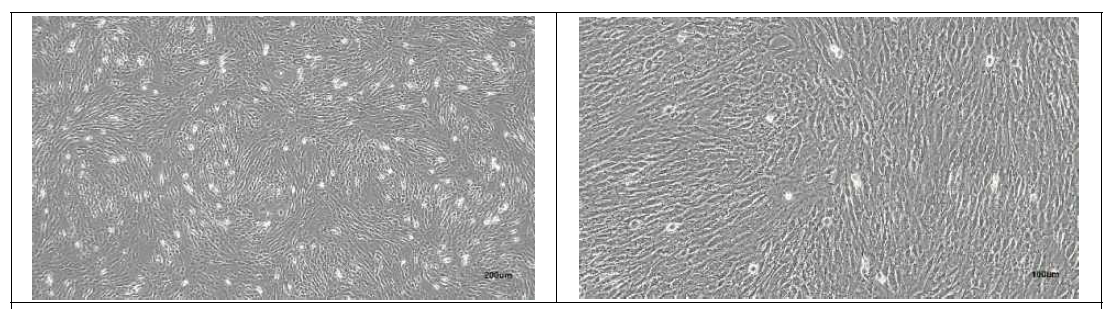 GalT-MCP/-MCP/CD73 돼지 귀조직에서 분리 및 배양중인 섬유아세포, 좌(40배율), 우(100배율)