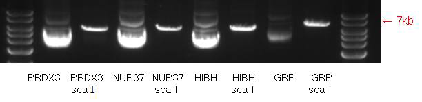 PRDX3, NUP37, 그리고 HIBADH가 삽입된 플라스미드의 확인