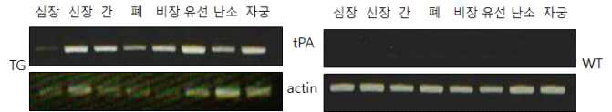 htPA 형질전환 돼지의 장기별 htPA mRNA 발현 분석