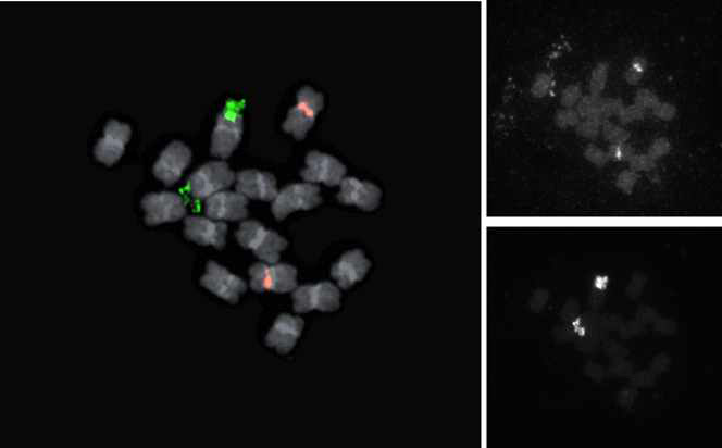 5S rDNA(2 loci, red-flurescence)와 45S rDNA(2 loci, green-flurescence)를 이용한 B. vulgaris의 FISH 핵형분석