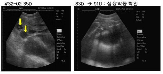 초기 및 후기 초음파 임신 진단