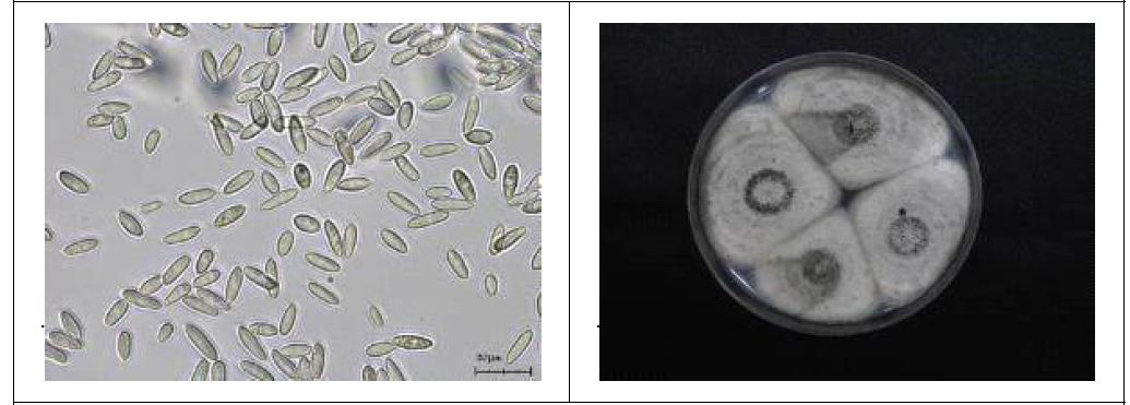 블루베리 탄저병균 분생포자(좌) 및 PDA고체배지 배양사진 (우)