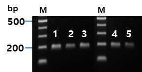 양파노균병균 DNA를 이용한 프라이머 세트별 특이유전자 증폭 유무 검정(M: DNA ladder, 1~5: 등온증폭용 프라이머의 F3/B3 세트)