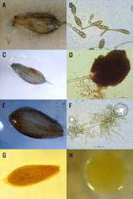 Microscopic observation of lettuce seeds with Alternaria sp. (A, B), Aspergillus sp, (C, D), Cladosporium sp. (E, F) and Pseudomonas sp. (G, H)